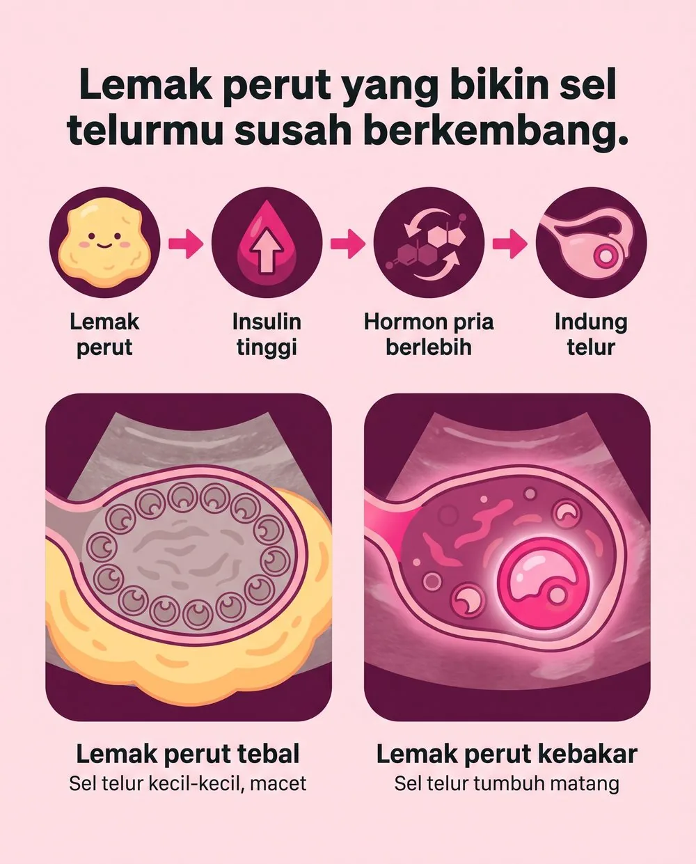Lemak perut bikin insulin tinggi, hormon pria berlebih, dan sel telur di indung telur macet. Saat lemak perut kebakar, sel telur bisa tumbuh matang.